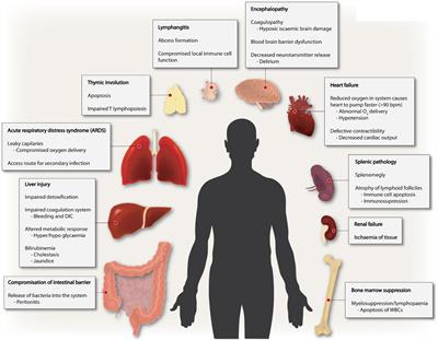 Sepsis: Inflammation Is a Necessary Evil